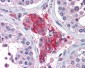 ACYP1 Antibody (Internal)